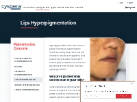What is hyperpigmentation of the lips? Cyspera by Scientis