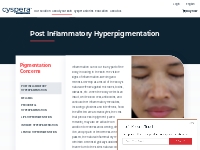 What is post-inflammatory hyperpigmentation? - Scientis