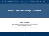 Crown   Bridges - Dental Home