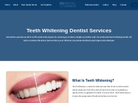 Teeth Whitening - Dental Home