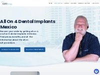 All ON 4 Dental Implants Mexico • Cost 2024