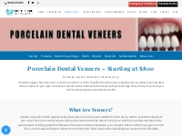 Porcelain Dental Veneers | Family and Cosmetic Dentist | Fontana