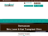 Female Hair Transplant - Dermawave