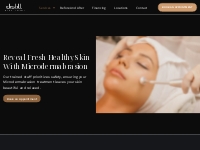 Microdermabrasion in Toronto, Acne Treatment in Toronto - Distill