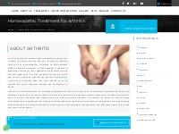 Homeopathic for Arthritis