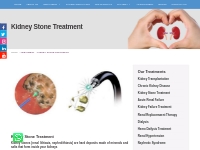 kidney Stone Doctor in Noida | kidney Stone Treatment in Noida | Kidne