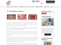 Dental Braces   Orthodontic Treatment | Teeth Braces - Dr. Bhalla