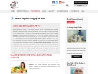 Dental Implants India, Affordable Teeth Implant Surgery   Treatment