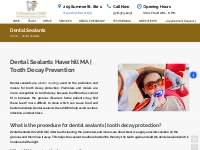 Dental Sealants Haverhill MA | Tooth Decay Protection | Call Now