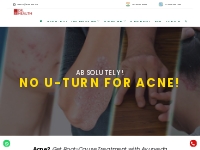 Ayurvedic Treatment for Acne - Dr. Health