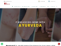 Ayurvedic Treatment for Psoriasis - Dr. Health
