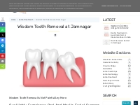 Wisdom Tooth Removal at Jamnagar ~ Dr. Bharat Katarmal Dental   Implan