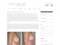 Breast Lift in Beverly Hills Ca | Lloyd Krieger MD