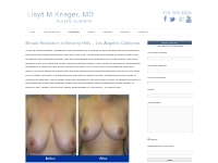 Breast Reduction in Beverly Hills - Los Angeles CA