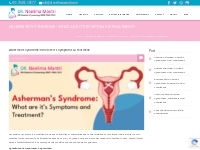 Asherman's Syndrome: What are its Symptoms   Treatment