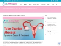 Tubo Ovarian Abscess: Symptoms Causes   Treatment
