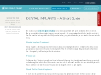DENTAL IMPLANTS – A Short Guide - Dr Paulo Pinho