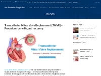 Transcatheter Mitral Valve Replacement: Procedure, Benefits   Recovery