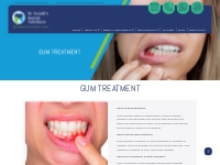 Gum treatment | Affordable dentistry