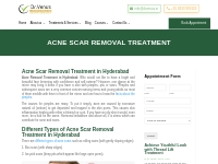 Acne Scar Removal Treatment in Hyderabad | Dr Venus