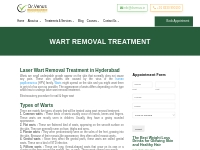 Wart Removal Treatment in Hyderabad - Dr Venus Skin