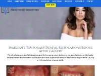 Temporary Dental Restorations Gallery | Before   After Gallery