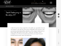  Teeth Reshaping in Brooklyn, NY - Cosmetic Dental Contouring