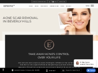 Facial Acne Scar Removal Los Angeles | Beverly Hills Acne Treatment