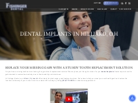 Dental Implants in Hilliard, OH | Fishinger Dental