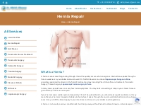 Hernia Treatment - Gastrolivercare