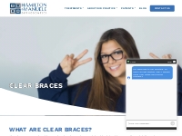 Clear Braces - Hamilton   Manuele Orthodontics