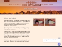 Dental Implants in Prescott, AZ | Hicks Dental Group