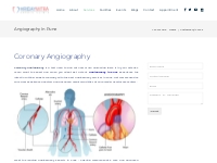 Angiography in Pune - Dr. Rahul Sawant