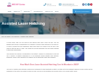 Assisted Laser Hatching - IRIS IVF Centre