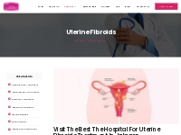 Uterine Fibroids Treatment in Jalgaon| Fibroid Surgery in Jalgaon