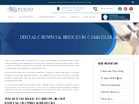 Dental Crowns   Bridges in Chandler, AZ | Kyrene Family Dentistry