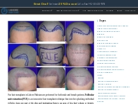 FUE hair transplants Lahore Pakistan | 1662 grafts hairline | Free adv