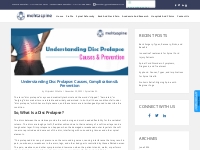 Understanding Disc Prolapse: Causes, Complications   Prevention