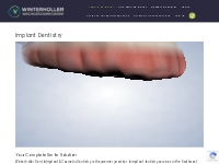 Implant Dentistry Procedures Archive | Winterholler Dental Implants   
