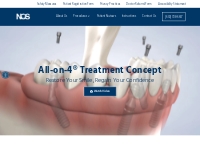 All-on-4® Treatment Concept   Naperville Oral Surgery   Dental Implant