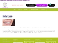 Dental Braces in st. Catharines, Linwell | Narwal Dental