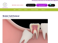 Wisdom Tooth Removal Dentistry in St. Catharines , Linwell