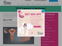 PCOS Treatment in Marathahalli, Bangalore