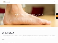Flat Foot Surgery Singapore - Flat Foot Reconstruction