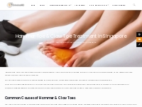 Hammer Toe Treatment | Claw Toe Singapore - OrthofootMD