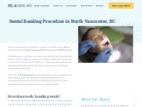Dental Bonding Procedure North Vancouver | Peak Dental Arts