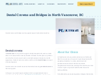 Dental Crowns and Bridges North Vancouver | Peak Dental Arts