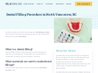 Dental Filling Procedure North Vancouver | Peak Dental Arts