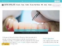 Dental Implants in Pleasanton, CA | Gateway Dental Care