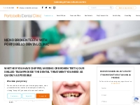 Broken Teeth Treatment in Dublin | Portobello Dental Clinic